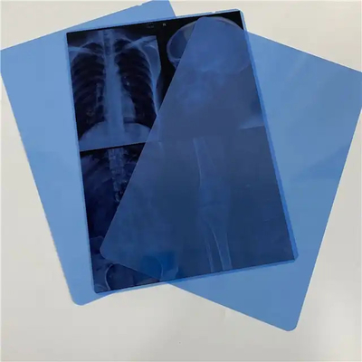 Tintaufdruckbare PET-Trocknlaser-X-Ray-Film Transparente blaue Basis für Diagnostikbilder