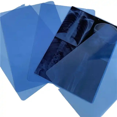Tintaufdruckbare PET-Trocknlaser-X-Ray-Film Transparente blaue Basis für Diagnostikbilder