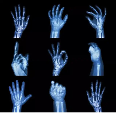 Tintaufdruckbare PET-Trocknlaser-X-Ray-Film Transparente blaue Basis für Diagnostikbilder