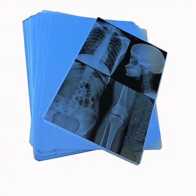 Blaue Thermal Inkjet-Röntgenfilm auf PET-Basis für Kliniken und Krankenhäuser