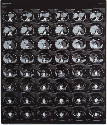 Hochdurchsichtiges medizinisches Röntgenfilm FUJI DIHT 14*17in Lasertrockenbildfilm