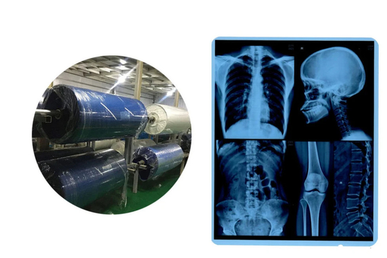 Medizinische Röntgenfilmrollen Tintenstrahlblaue Basis für CR DR CT MRT-Bild-Ausgabe