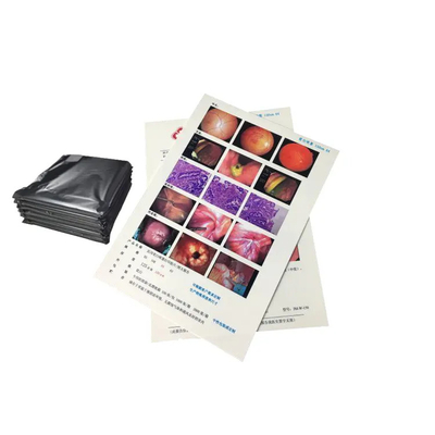 PET-Filmbasis Blau Transparente Farbe Medizinische Röntgenfilme zur Röntgendiagnostik