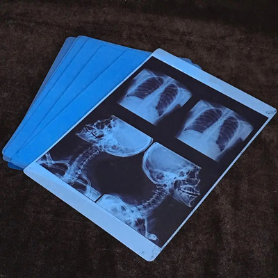 High Resolution Blau-Weiß medizinische Röntgenfilme mit glänzender Oberfläche