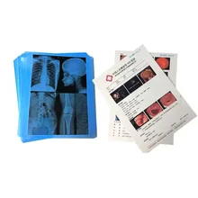 Kompatibilität Canon / Epson Inkjet-Drucker Inkjet-X-Ray-Film 210 Mikronen Blaue Filmdicke