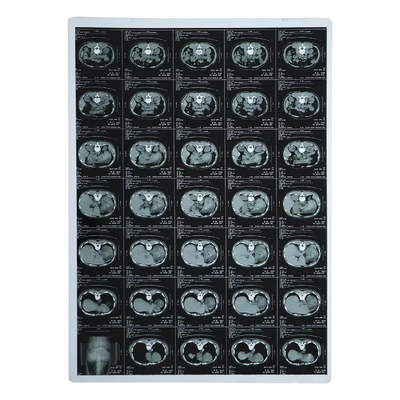 210 Mikronen Röntgenfilm Medizinischer Inkjet-Laser für CT