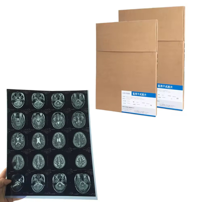 Dry Pix X-Ray Film Fuji DIHL X-Ray Medical Dry Laser Imaging X-Ray Film
