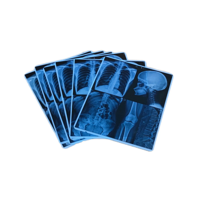 Hohe Bildstabilität Blaue medizinische Film Inkjet für Inkjet-Röntgenfilm