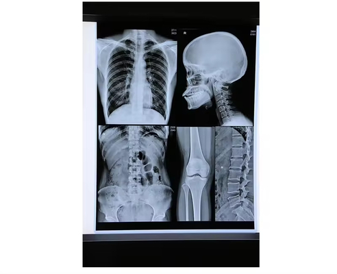 Blue Inkjet Medical X-Ray Film Medizinischer Trockenfilm A4 Blatt oder in Rollen Noch keine Bewertungen