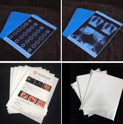 Röntgenfilm für medizinische Zwecke kompatibel mit Canon HP und Epson Inkjet Filmprinter