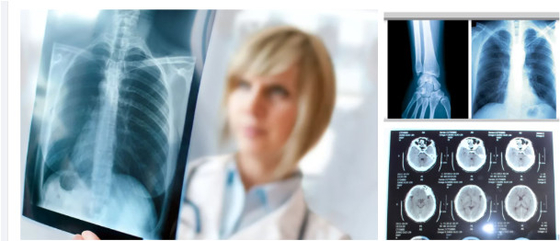 Blau-Weiß-Röntgenfilm für genaue Diagnostik