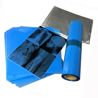 Blau-Weiß-Röntgenfilm für genaue Diagnostik