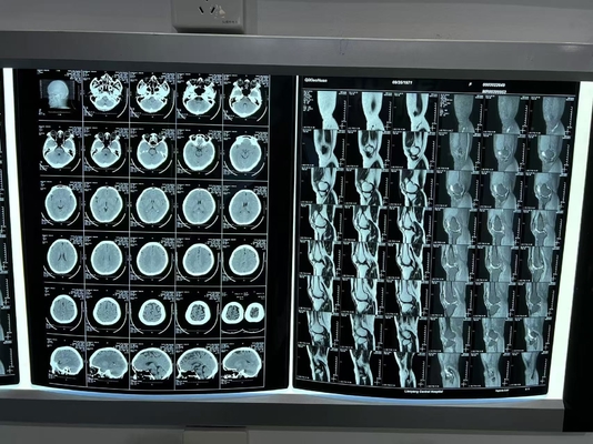 Blauer Laser-X-Strahl-Wärmedruckfilm für radiologische Bildgebung