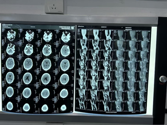 Dichteverbesserte Diagnostiklaser-Röntgenfilm 0,28D für medizinische Geräte