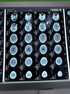 3.0D Kontrast überlegene Flexibilität Laser trockener Röntgenfilm für medizinische Zwecke