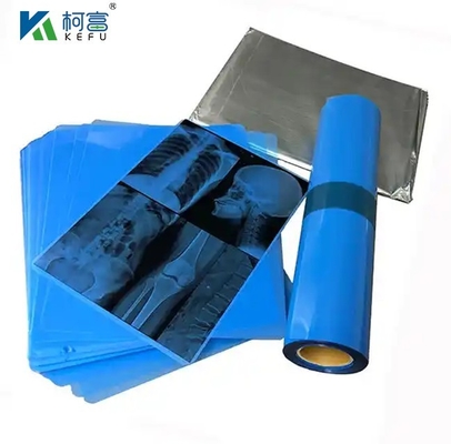 Blaue PET-basierte Röntgenthermische/Inkjet-Filme für Kliniken und Krankenhäuser