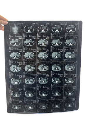 Blauer medizinischer Trockenfilm-Röntgenbild-Ausgabe-Inkjet-Drucker für medizinische Maschine