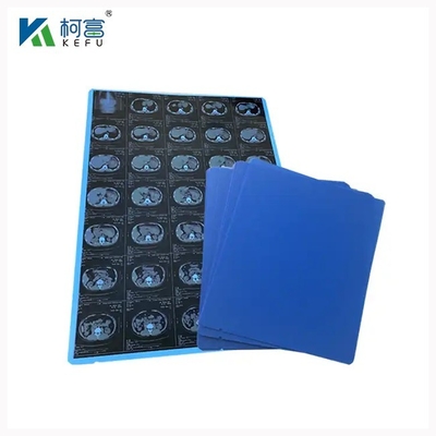 Radiologie PET Trockene Tintenstrahlblaue medizinische Folie 8x10 10x12 11x14 14x17 Zoll medizinische orthopädische Röntgenaufnahmen