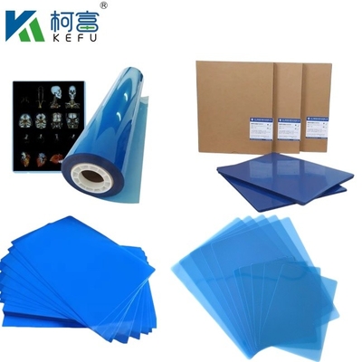 angepasste Größe Blaue PET-basierte Röntgenfarbe/Laserfilm medizinische Bilder für Kliniken und Krankenhäuser