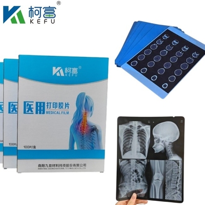 angepasste Größe Blaue PET-basierte Röntgenfarbe/Laserfilm medizinische Bilder für Kliniken und Krankenhäuser