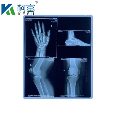 angepasste Größe Blaue PET-basierte Röntgenfarbe/Laserfilm medizinische Bilder für Kliniken und Krankenhäuser