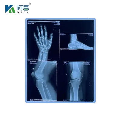 Blaue PET-basierte Röntgenfarbenstrahl- / Laserfilm-Medizinische Bilder für Kliniken und Krankenhäuser