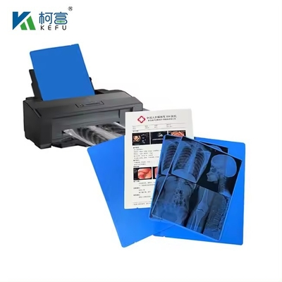 Blaue PET-basierte Röntgenfarbenstrahl- / Laserfilm-Medizinische Bilder für Kliniken und Krankenhäuser