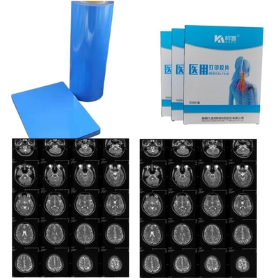 Medizinisches Bild Trocken PET Inkjet Laser Medizinischer Röntgenfilm 14x17 Zoll