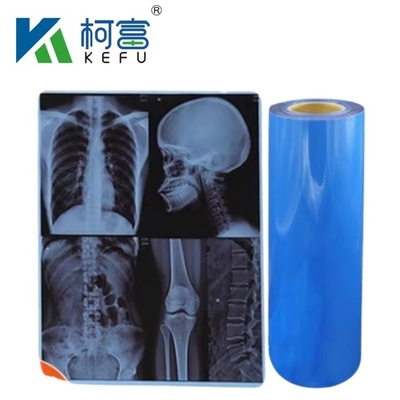 Wasserdichte medizinische Röntgentechnische Wärmefilm X-Ray Blaufilm für Inkjet-Drucker