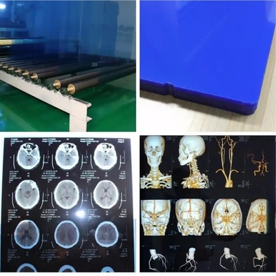 Wasserdichte medizinische Röntgentechnische Wärmefilm X-Ray Blaufilm für Inkjet-Drucker