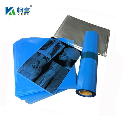 175mic 215mic High Definition Medizinische Bildgebung CT DR Inkjet Blaufilm Medizinische Röntgenfilm für Haustiere A3 A4 Transparent Blaudruckfilm