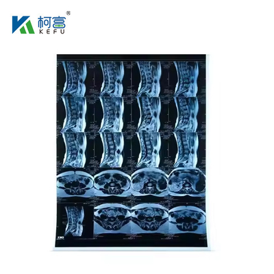 Inktjet-Medizinische Röntgenstrahlblaue Folie 210 Mikron CT DR Film A4 8x10 Blatt oder Rolle für medizinische Inkjet-Druckmedien