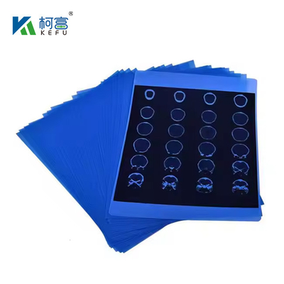 Inktjet-Medizinische Röntgenstrahlblaue Folie 210 Mikron CT DR Film A4 8x10 Blatt oder Rolle für medizinische Inkjet-Druckmedien