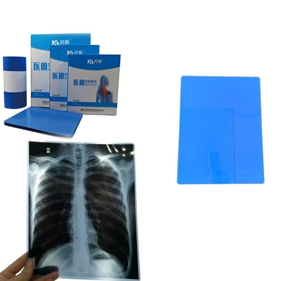 A4-Dimension Blatt Blaue Tintenstrahl-Röntgenfilm für medizinische Bilddrucke Röntgen CT CR DR MTR PET