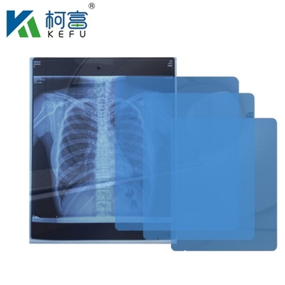 High-Definition-Medizinische Bildgebung CT DR Inkjet-Medizinische Röntgenaufnahme 175mic 215mic Transparent Blau-Druckfilm