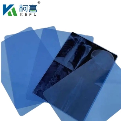 X-Ray Thermal Medical Film 8*10 14*17 Blaufarbiger medizinischer Trockenbildfilm mit Drucker