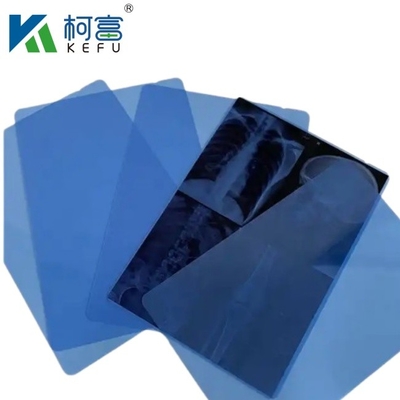 Laserthermischer Druck Röntgenfilm Halbtransparenter Röntgen-Inkjet-Medizinischer Blaufilm