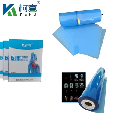 Laserthermischer Druck Röntgenfilm Halbtransparenter Röntgen-Inkjet-Medizinischer Blaufilm