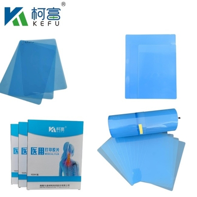 X-Ray Thermal Medical Film 8*10 14*17 Blaufarbiger medizinischer Trockenbildfilm mit Drucker
