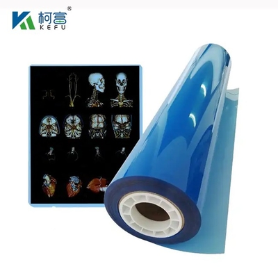 High-Definition und Wide-Gamut Medical Laser Film 17x22in 0.17mm für detaillierte und anschauliche medizinische Untersuchungen