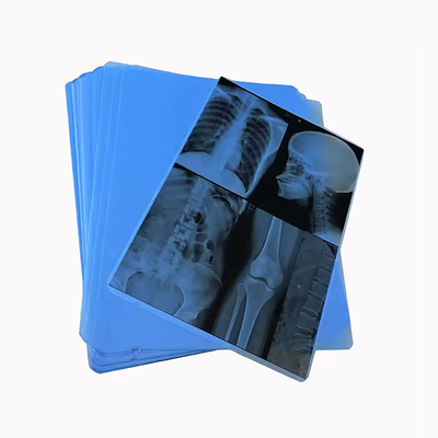 Unsere professionell hergestellte medizinische Blaue Röntgenfilm für den Laserdruck ist die Wahl.