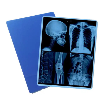 Unsere professionell hergestellte medizinische Blaue Röntgenfilm für den Laserdruck ist die Wahl.