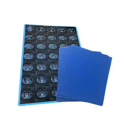 11*14 Größe Medizinische blaue Röntgenfilm für den Laserdruck