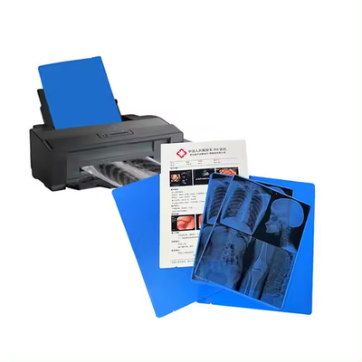 Medizinisches Blaues Röntgenfilm für den Laserdruck hat einen guten Erfolgsbericht