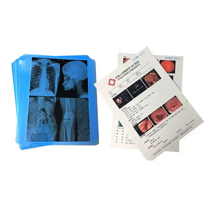Medizinischer Blauer Röntgenfilm zum Laserdruck von medizinischen Versorgungsmitteln