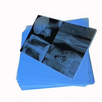 Medizinischer Blauer Röntgenfilm zum Laserdruck von medizinischen Versorgungsmitteln