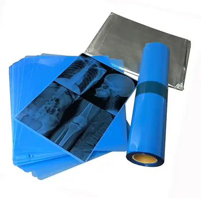 Medizinischer Blauer Röntgenfilm zum Laserdruck von medizinischen Versorgungsmitteln