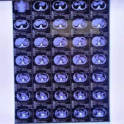 Kostengünstige medizinische Röntgenfilme mit hoher Bildstabilität, die klare und präzise medizinische Diagnosebilder liefern