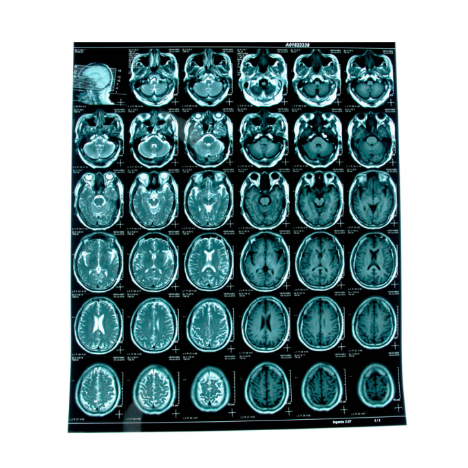 Blaue Tintenstrahlfilm für medizinische X-Ray-Filme für medizinische Trockenfolie A4 A3 in Blättern oder Rollen 0