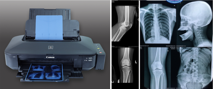 Hochwertige medizinische Röntgenaufnahme mit trockener blauer Folie für die Tintenstrahlung 3